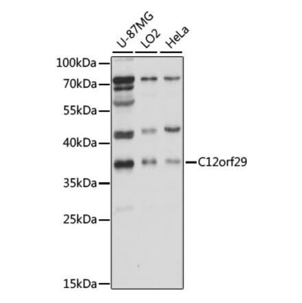 Western Blot - Anti-RLIG1 Antibody (A89546) - Antibodies.com