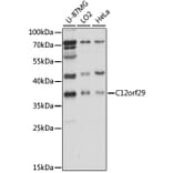 Western Blot - Anti-RLIG1 Antibody (A89546) - Antibodies.com