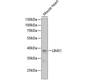 Western Blot - Anti-PINCH 1 Antibody (A89547) - Antibodies.com