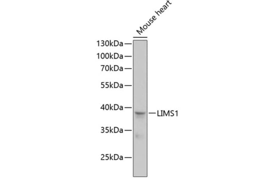 Western Blot - Anti-PINCH 1 Antibody (A89547) - Antibodies.com