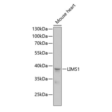 Western Blot - Anti-PINCH 1 Antibody (A89547) - Antibodies.com