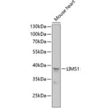 Western Blot - Anti-PINCH 1 Antibody (A89547) - Antibodies.com