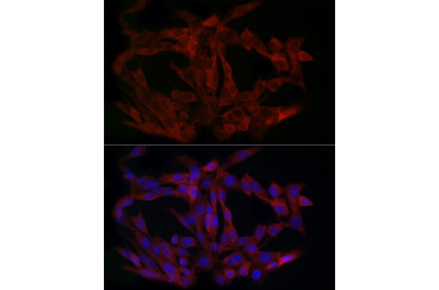 Immunofluorescence - Anti-PINCH 1 Antibody (A89547) - Antibodies.com