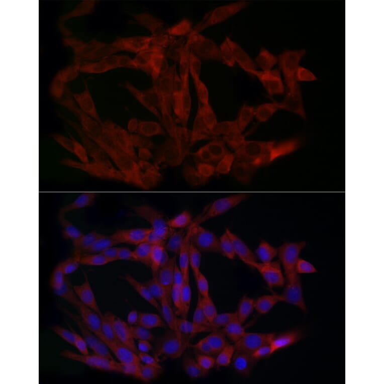 Immunofluorescence - Anti-PINCH 1 Antibody (A89547) - Antibodies.com