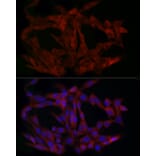 Immunofluorescence - Anti-PINCH 1 Antibody (A89547) - Antibodies.com