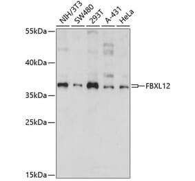 Western Blot - Anti-FbxL12 Antibody (A89548) - Antibodies.com
