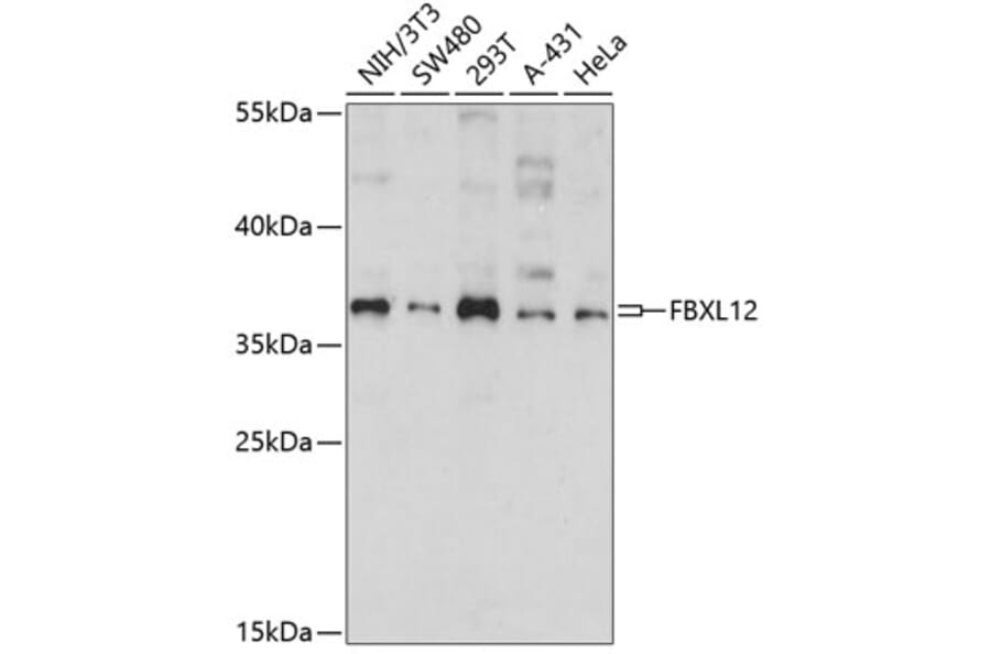 Western Blot - Anti-FbxL12 Antibody (A89548) - Antibodies.com