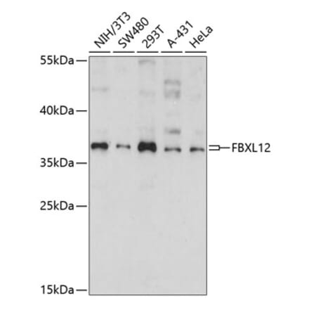 Western Blot - Anti-FbxL12 Antibody (A89548) - Antibodies.com