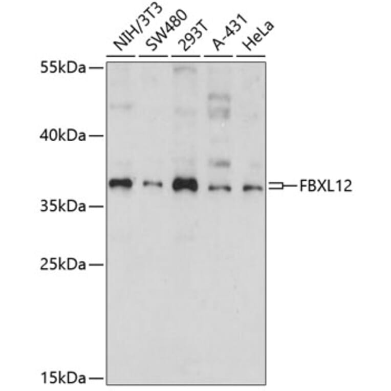 Western Blot - Anti-FbxL12 Antibody (A89548) - Antibodies.com