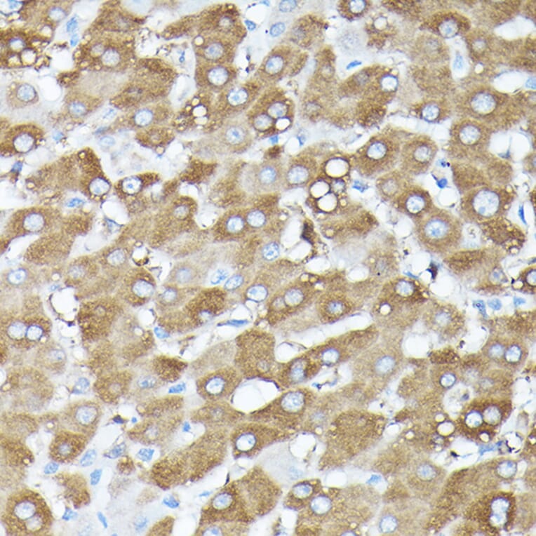Immunohistochemistry - Anti-G protein beta subunit like/GBL Antibody (A89549) - Antibodies.com