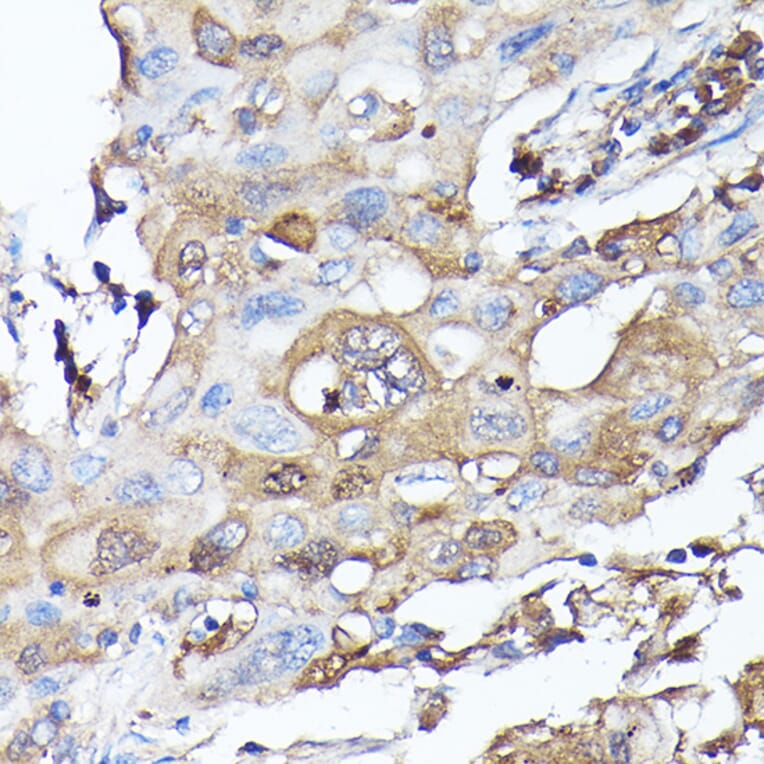 Immunohistochemistry - Anti-G protein beta subunit like/GBL Antibody (A89549) - Antibodies.com