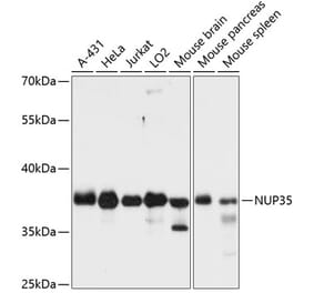 Western Blot - Anti-NUP35 Antibody (A89550) - Antibodies.com