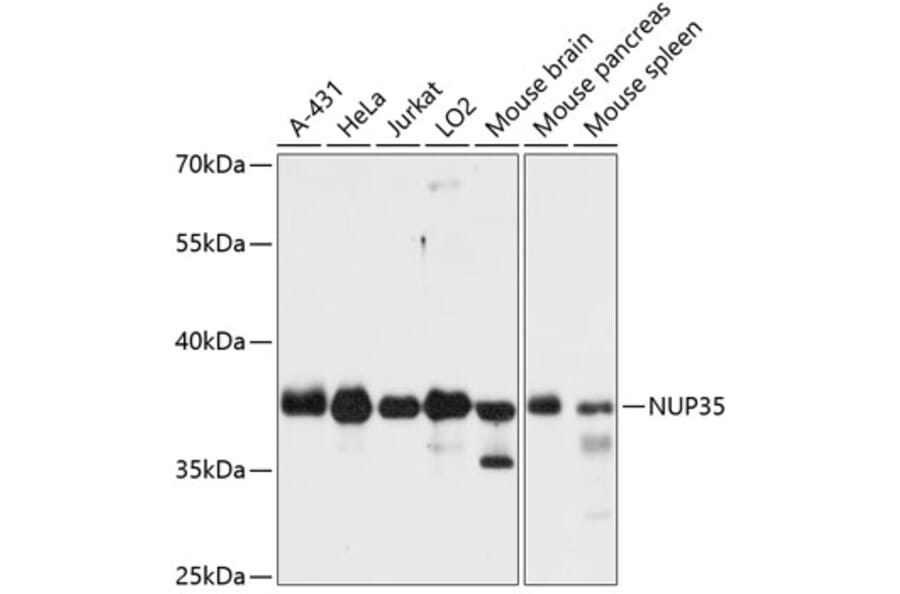 Western Blot - Anti-NUP35 Antibody (A89550) - Antibodies.com