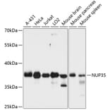 Western Blot - Anti-NUP35 Antibody (A89550) - Antibodies.com
