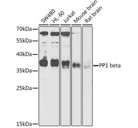 Western Blot - Anti-PPP1CB Antibody (A89551) - Antibodies.com