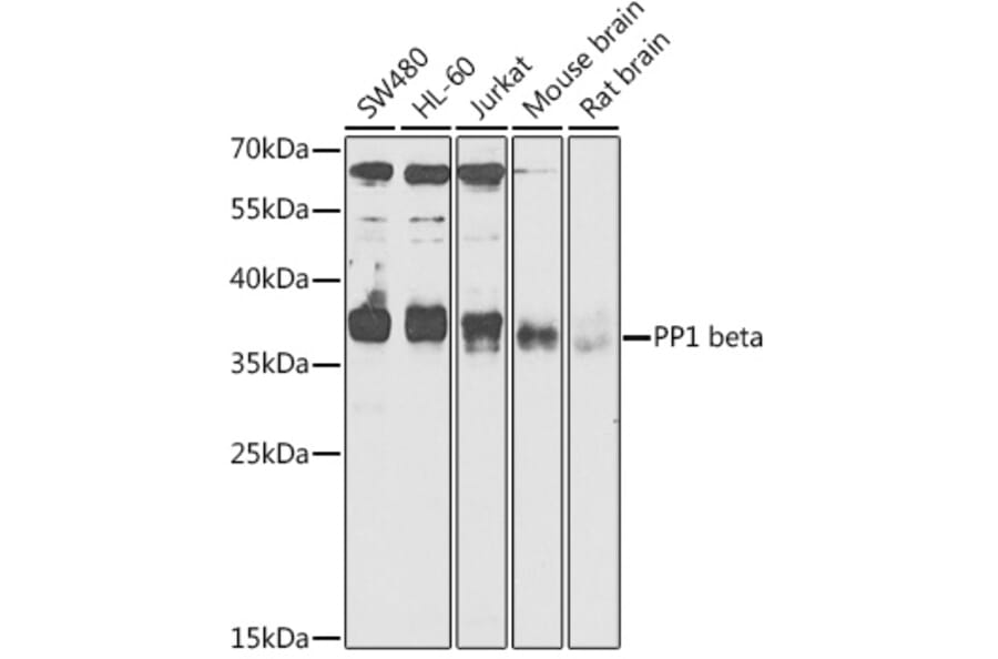 Western Blot - Anti-PPP1CB Antibody (A89551) - Antibodies.com