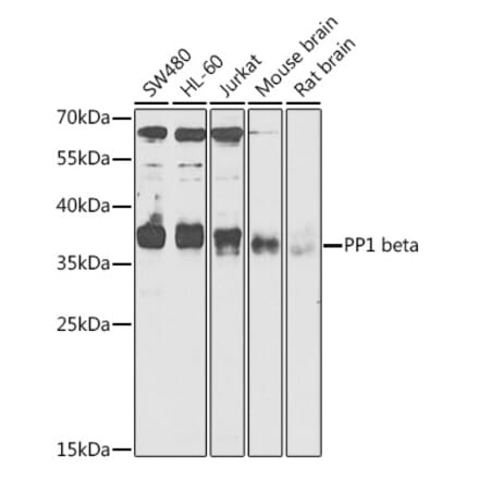 Western Blot - Anti-PPP1CB Antibody (A89551) - Antibodies.com