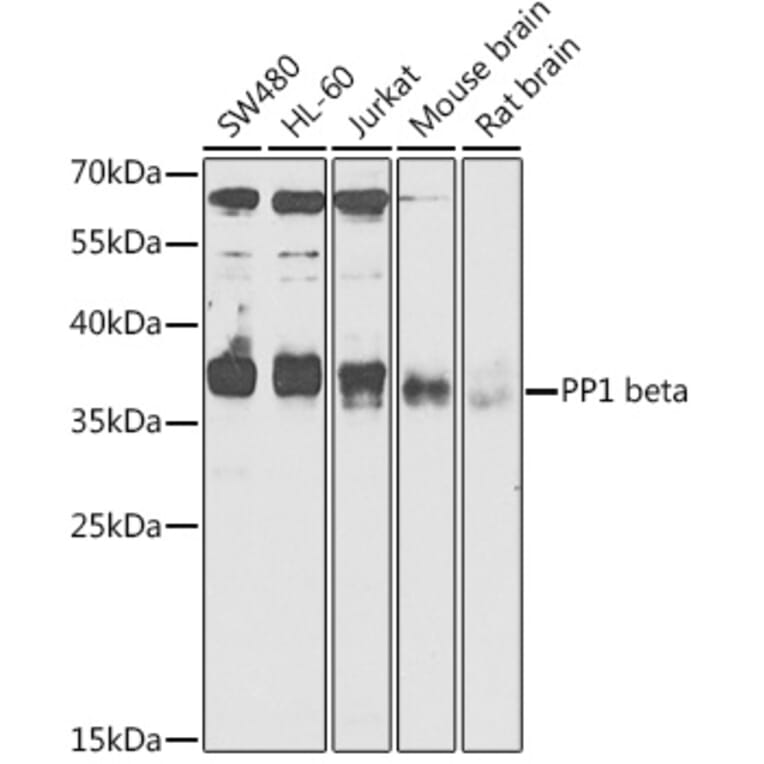 Western Blot - Anti-PPP1CB Antibody (A89551) - Antibodies.com