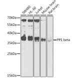 Western Blot - Anti-PPP1CB Antibody (A89551) - Antibodies.com