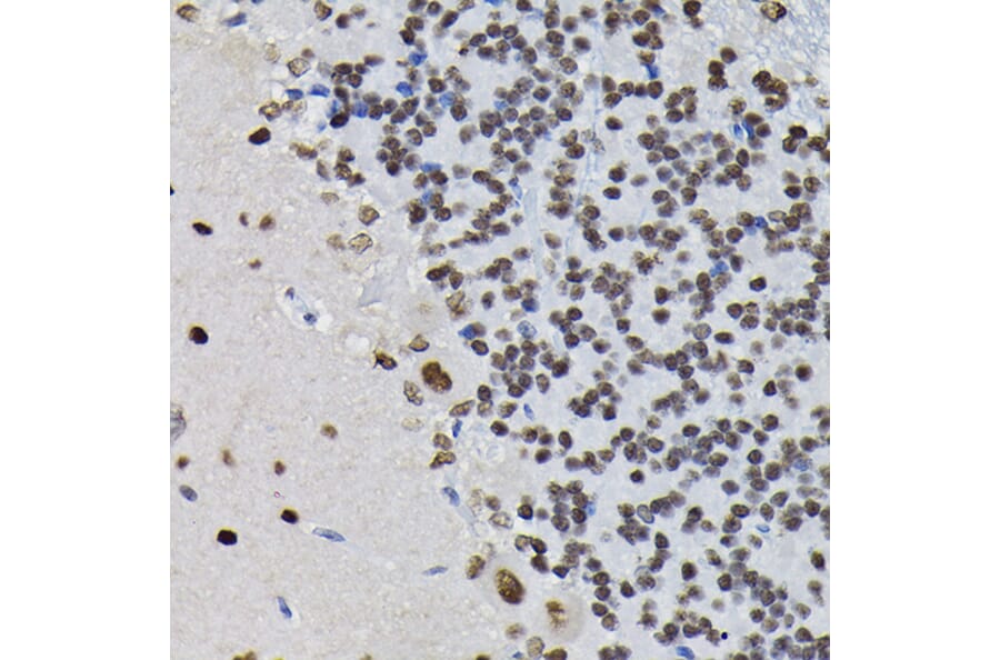 Immunohistochemistry - Anti-PPP1CB Antibody (A89551) - Antibodies.com