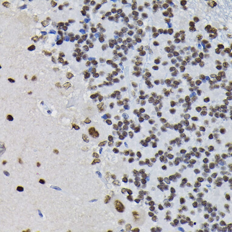 Immunohistochemistry - Anti-PPP1CB Antibody (A89551) - Antibodies.com