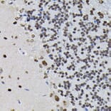 Immunohistochemistry - Anti-PPP1CB Antibody (A89551) - Antibodies.com
