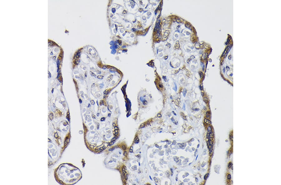 Immunohistochemistry - Anti-PPP1CB Antibody (A89551) - Antibodies.com