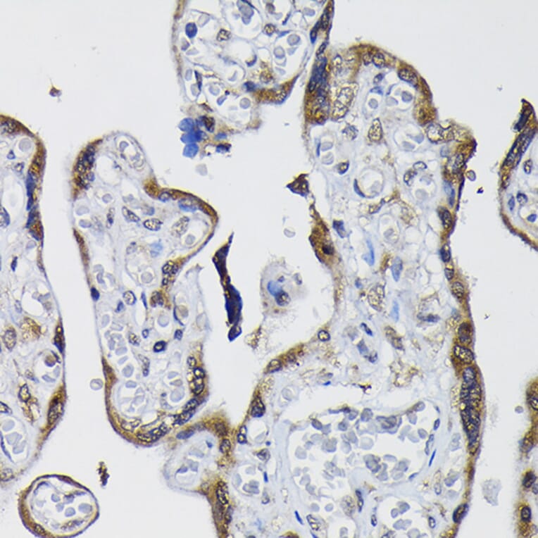 Immunohistochemistry - Anti-PPP1CB Antibody (A89551) - Antibodies.com
