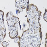 Immunohistochemistry - Anti-PPP1CB Antibody (A89551) - Antibodies.com