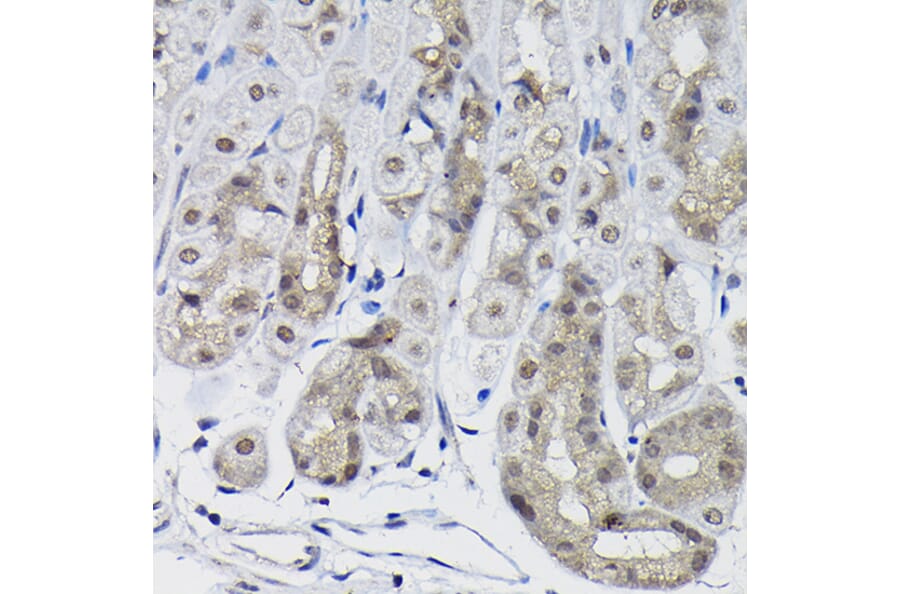 Immunohistochemistry - Anti-PPP1CB Antibody (A89551) - Antibodies.com