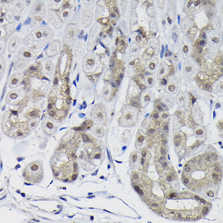 Immunohistochemistry - Anti-PPP1CB Antibody (A89551) - Antibodies.com