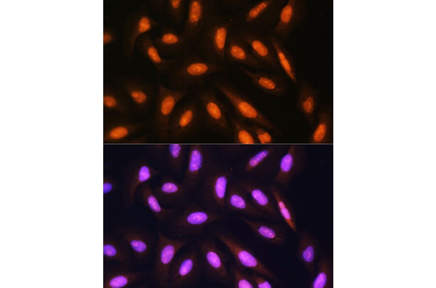 Immunofluorescence - Anti-PPP1CB Antibody (A89551) - Antibodies.com
