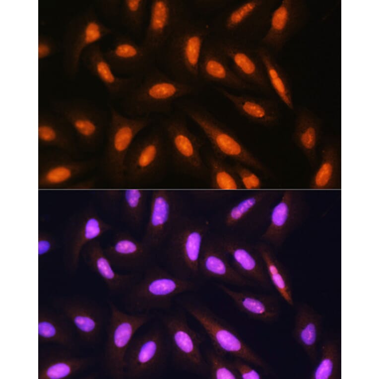 Immunofluorescence - Anti-PPP1CB Antibody (A89551) - Antibodies.com