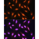 Immunofluorescence - Anti-PPP1CB Antibody (A89551) - Antibodies.com