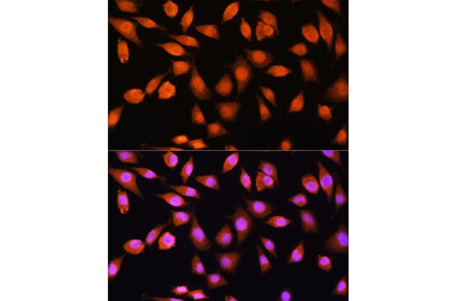 Immunofluorescence - Anti-PPP1CB Antibody (A89551) - Antibodies.com