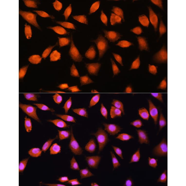 Immunofluorescence - Anti-PPP1CB Antibody (A89551) - Antibodies.com