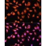 Immunofluorescence - Anti-PPP1CB Antibody (A89551) - Antibodies.com