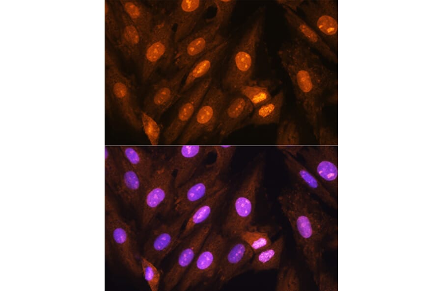 Immunofluorescence - Anti-PPP1CB Antibody (A89551) - Antibodies.com