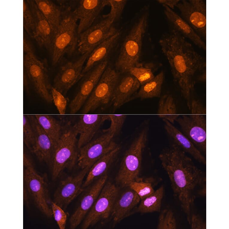 Immunofluorescence - Anti-PPP1CB Antibody (A89551) - Antibodies.com