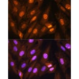 Immunofluorescence - Anti-PPP1CB Antibody (A89551) - Antibodies.com