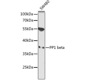 Western Blot - Anti-PPP1CB Antibody (A89552) - Antibodies.com