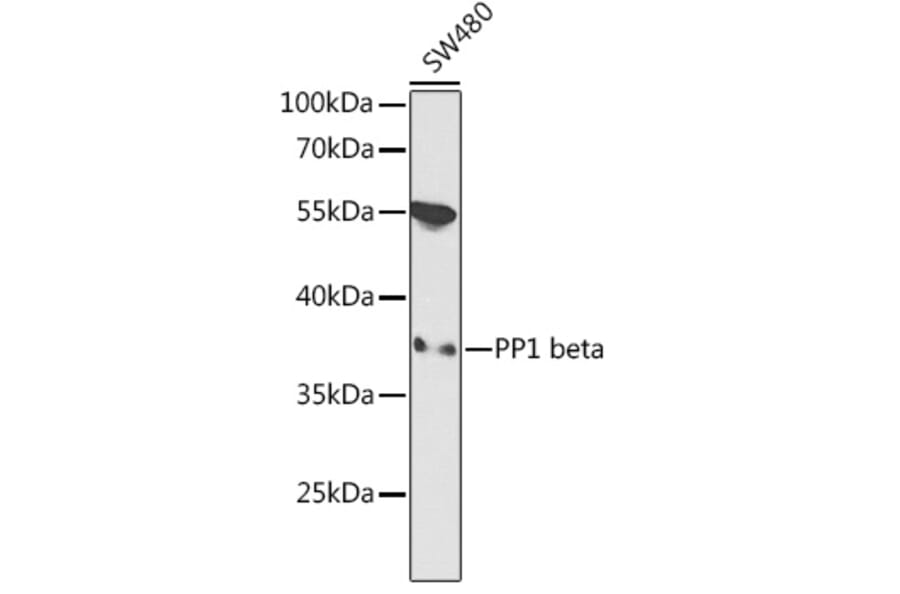 Western Blot - Anti-PPP1CB Antibody (A89552) - Antibodies.com