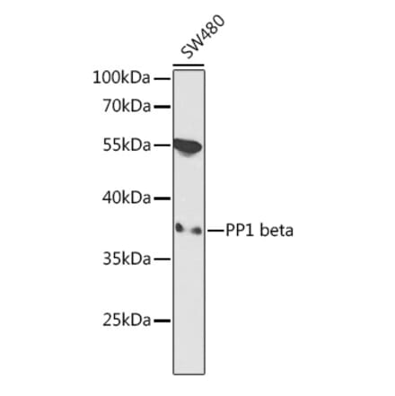 Western Blot - Anti-PPP1CB Antibody (A89552) - Antibodies.com
