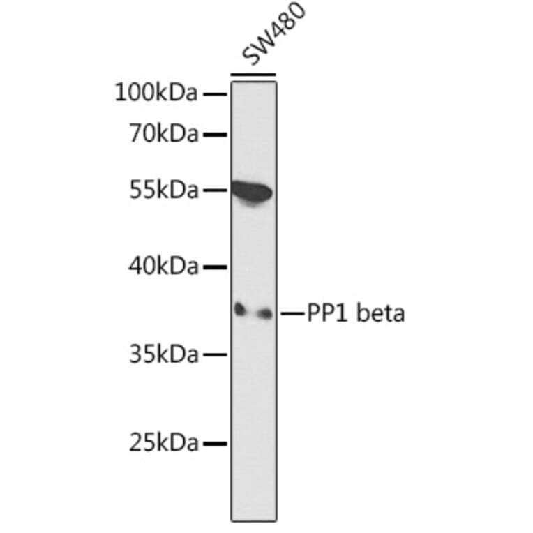 Western Blot - Anti-PPP1CB Antibody (A89552) - Antibodies.com