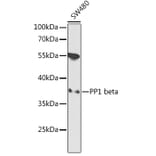 Western Blot - Anti-PPP1CB Antibody (A89552) - Antibodies.com