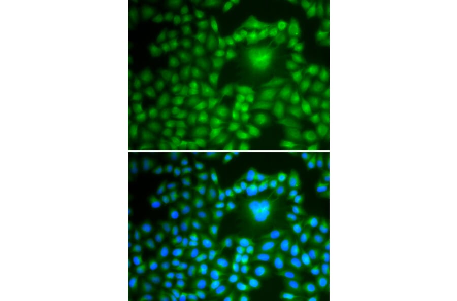 Immunofluorescence - Anti-PPP1CB Antibody (A89552) - Antibodies.com