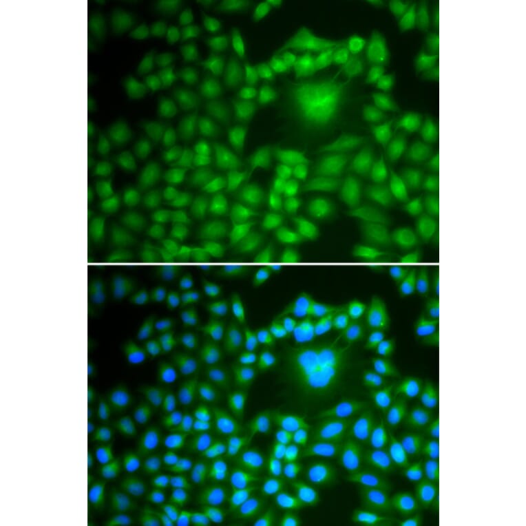 Immunofluorescence - Anti-PPP1CB Antibody (A89552) - Antibodies.com