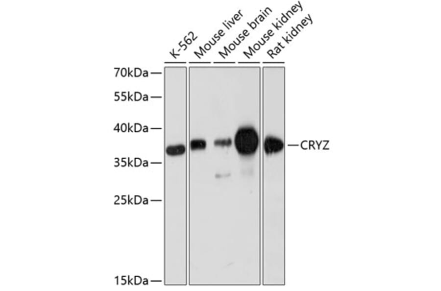 Western Blot - Anti-Quinone oxidoreductase Antibody (A89553) - Antibodies.com