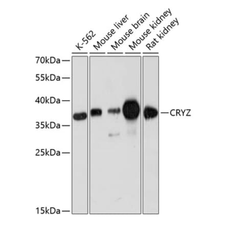 Western Blot - Anti-Quinone oxidoreductase Antibody (A89553) - Antibodies.com