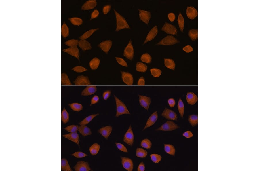 Immunofluorescence - Anti-Quinone oxidoreductase Antibody (A89553) - Antibodies.com